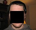 Click image for larger version

Name:	BeforeHairLoss.jpg
Views:	841
Size:	46.5 KB
ID:	441795