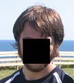 Click image for larger version

Name:	BeforeHairLossLong.jpg
Views:	812
Size:	92.3 KB
ID:	441796