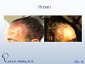 Click image for larger version

Name:	Slide1.jpg
Views:	377
Size:	63.5 KB
ID:	441917