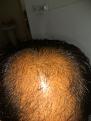Click image for larger version

Name:	IMG_20170105_093325.jpg
Views:	335
Size:	93.5 KB
ID:	441971
