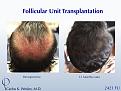 Click image for larger version

Name:	Slide4.jpg
Views:	292
Size:	84.6 KB
ID:	441982