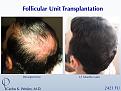 Click image for larger version

Name:	Slide6-2.jpg
Views:	291
Size:	87.3 KB
ID:	441984