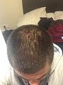 Click image for larger version

Name:	Hair 1.jpg
Views:	212
Size:	40.8 KB
ID:	442165