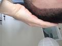Click image for larger version

Name:	10 Days Post Op 2.jpg
Views:	430
Size:	61.6 KB
ID:	442506