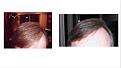 Click image for larger version

Name:	Hair 1-7-19.jpg
Views:	724
Size:	13.2 KB
ID:	443176