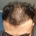 Click image for larger version

Name:	20190220_111215.jpg
Views:	919
Size:	87.1 KB
ID:	443271