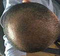 Click image for larger version

Name:	hair.jpg
Views:	248
Size:	87.8 KB
ID:	443539