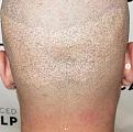 Click image for larger version

Name:	Fue Scar SMP before.jpg
Views:	233
Size:	89.5 KB
ID:	445302