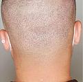 Click image for larger version

Name:	Fue Scar SMP after.jpg
Views:	224
Size:	93.1 KB
ID:	445303