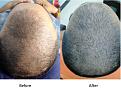 Click image for larger version

Name:	comparison after 3 month  final.jpg
Views:	453
Size:	51.5 KB
ID:	445457