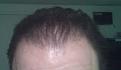 Click image for larger version

Name:	TJ-Hair10.jpg
Views:	1117
Size:	17.6 KB
ID:	445697