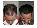 Click image for larger version

Name:	Slide5.JPG
Views:	9947
Size:	65.3 KB
ID:	445703