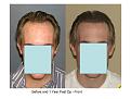 Click image for larger version

Name:	slide 1.JPG
Views:	962
Size:	59.0 KB
ID:	445720