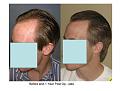 Click image for larger version

Name:	slide 2.JPG
Views:	871
Size:	62.7 KB
ID:	445721