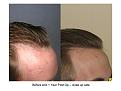 Click image for larger version

Name:	slide 3.JPG
Views:	856
Size:	64.6 KB
ID:	445722