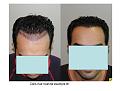 Click image for larger version

Name:	Slide1.JPG
Views:	1036
Size:	59.3 KB
ID:	445731