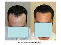 Click image for larger version

Name:	Slide10.JPG
Views:	979
Size:	55.4 KB
ID:	445737