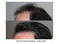 Click image for larger version

Name:	Slide13.JPG
Views:	998
Size:	62.6 KB
ID:	445741