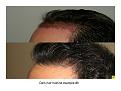 Click image for larger version

Name:	Slide14.JPG
Views:	955
Size:	65.7 KB
ID:	445742