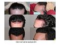 Click image for larger version

Name:	Slide17.JPG
Views:	991
Size:	78.3 KB
ID:	445744