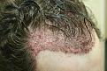 Click image for larger version

Name:	c immed post op.jpg
Views:	638
Size:	65.8 KB
ID:	445872