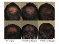 Click image for larger version

Name:	Slide1.JPG
Views:	1331
Size:	80.6 KB
ID:	445877