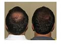 Click image for larger version

Name:	Slide3.JPG
Views:	1282
Size:	57.5 KB
ID:	445879