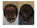 Click image for larger version

Name:	Slide6.JPG
Views:	1200
Size:	62.7 KB
ID:	445882