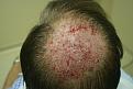 Click image for larger version

Name:	b NW immed post-op.jpg
Views:	653
Size:	26.6 KB
ID:	445899