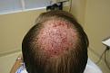 Click image for larger version

Name:	c NW immed post-op.jpg
Views:	682
Size:	22.2 KB
ID:	445900