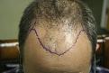 Click image for larger version

Name:	a DB pre-op.jpg
Views:	817
Size:	25.0 KB
ID:	445901