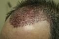 Click image for larger version

Name:	c DB immed post-op.jpg
Views:	760
Size:	27.9 KB
ID:	445903