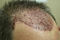 Click image for larger version

Name:	d DB immed post-op.jpg
Views:	745
Size:	31.3 KB
ID:	445904