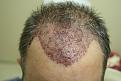 Click image for larger version

Name:	e DB immed post-op.jpg
Views:	825
Size:	26.8 KB
ID:	445905