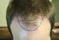 Click image for larger version

Name:	a PA pre-op.jpg
Views:	723
Size:	22.6 KB
ID:	445906