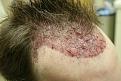 Click image for larger version

Name:	d PA immedpost-op.jpg
Views:	688
Size:	32.9 KB
ID:	445909