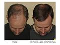 Click image for larger version

Name:	Slide5.JPG
Views:	785
Size:	62.2 KB
ID:	445965