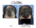 Click image for larger version

Name:	Head tilt down_view.jpg
Views:	725
Size:	92.9 KB
ID:	446014