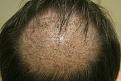 Click image for larger version

Name:	C RC 1 week Post-op.jpg
Views:	616
Size:	32.5 KB
ID:	446036
