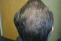 Click image for larger version

Name:	E RC 6 mn post-op.jpg
Views:	739
Size:	25.5 KB
ID:	446038