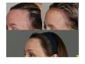 Click image for larger version

Name:	Slide3.JPG
Views:	982
Size:	60.0 KB
ID:	446045