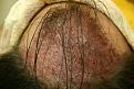 Click image for larger version

Name:	c JK immediately post op.jpg
Views:	1016
Size:	59.4 KB
ID:	446165