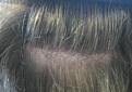 Click image for larger version

Name:	l JK scar.jpg
Views:	955
Size:	40.3 KB
ID:	446174