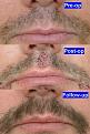 Click image for larger version

Name:	beard_4.jpg
Views:	537
Size:	55.8 KB
ID:	446175