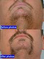 Click image for larger version

Name:	beard_3.jpg
Views:	515
Size:	73.2 KB
ID:	446176