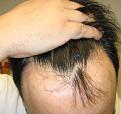 Click image for larger version

Name:	Hairline1.jpg
Views:	19033
Size:	90.2 KB
ID:	446201