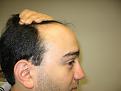 Click image for larger version

Name:	Hairline2.jpg
Views:	28055
Size:	91.2 KB
ID:	446202