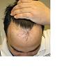 Click image for larger version

Name:	Hairline3.jpg
Views:	12533
Size:	77.4 KB
ID:	446203