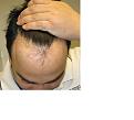 Click image for larger version

Name:	Hairline3.jpg
Views:	12855
Size:	77.4 KB
ID:	446203