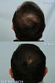 Click image for larger version

Name:	crown.jpg
Views:	681
Size:	44.0 KB
ID:	446224